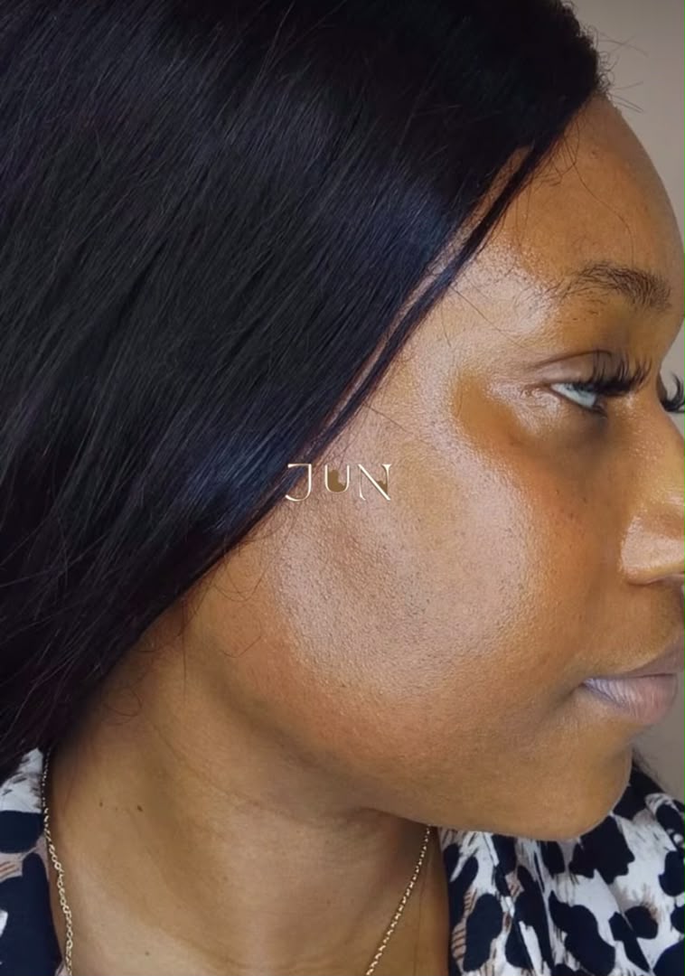 Before treatment