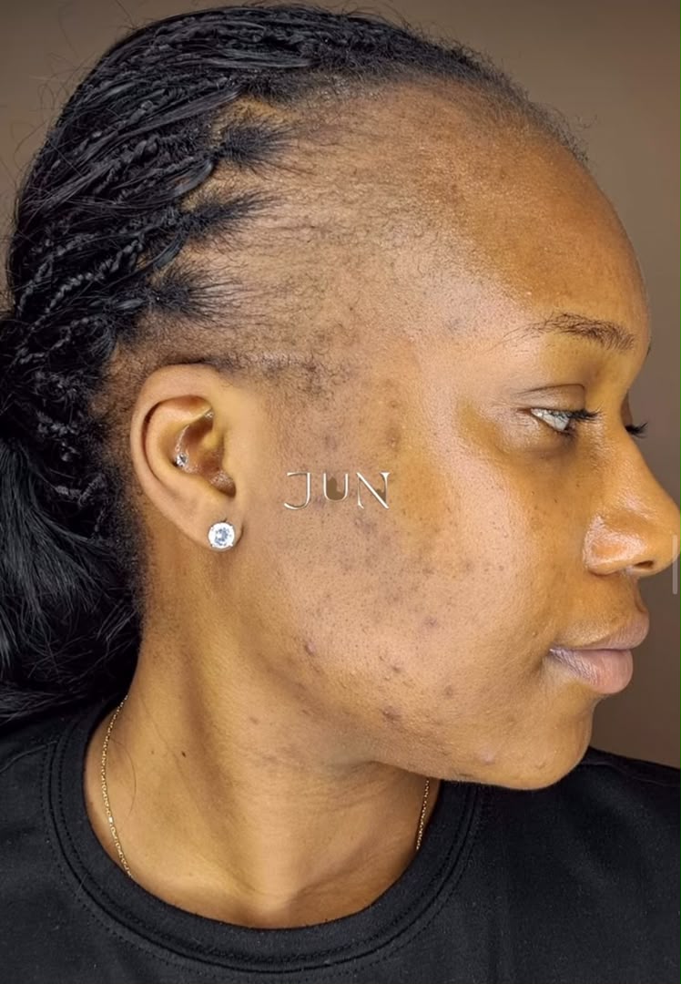 After treatment
